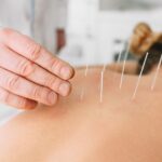 Como montar uma clínica de acupuntura e medicina chinesa em Curitiba e se diferenciar no mercado