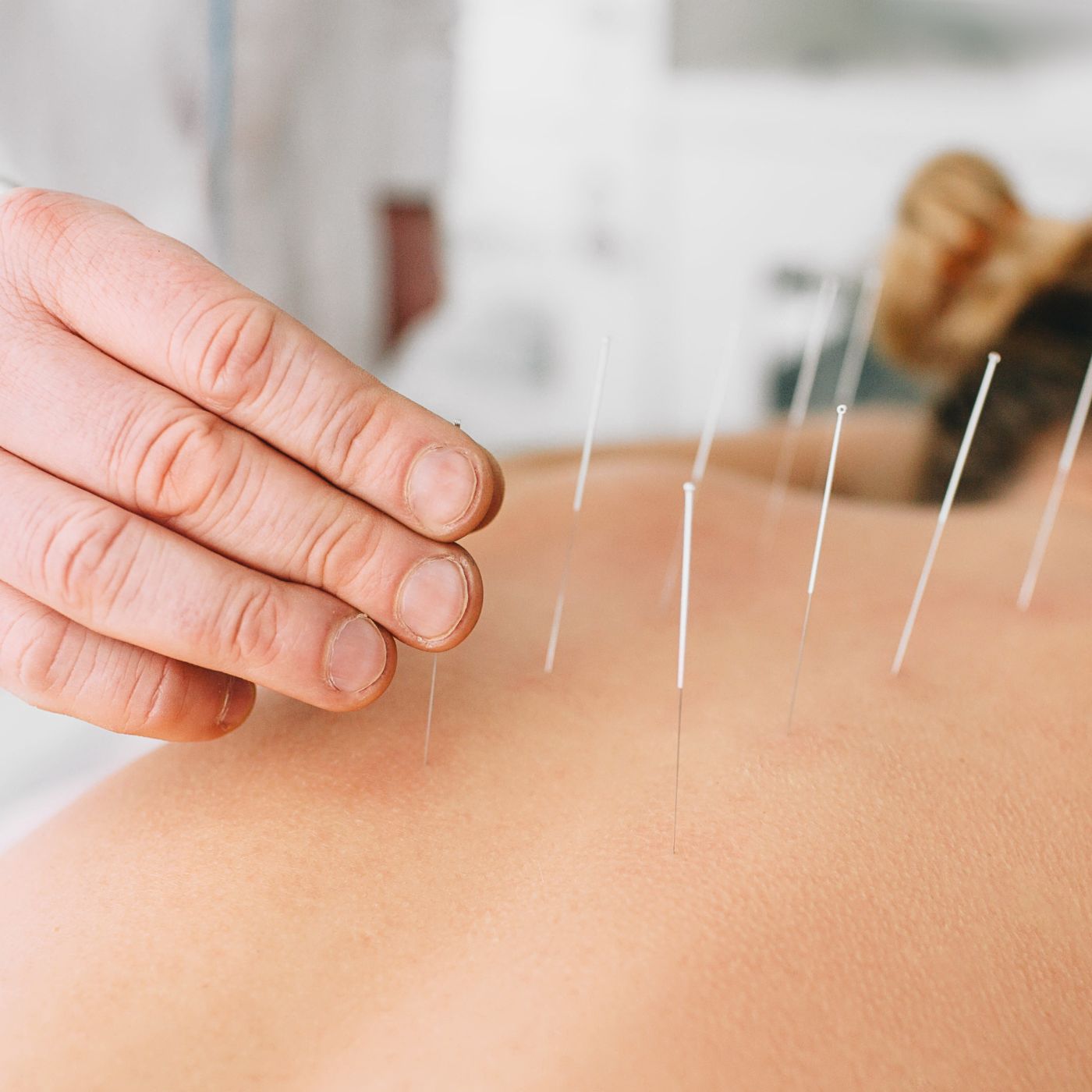 Como montar uma clínica de acupuntura e medicina chinesa em Curitiba e se diferenciar no mercado
